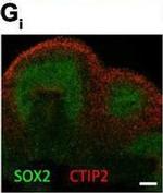 Rabbit IgG (H+L) Highly Cross-Adsorbed Secondary Antibody in Immunocytochemistry (ICC/IF)