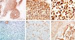 DUX4 Antibody in Immunohistochemistry (IHC)