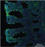 BPI Antibody in Immunohistochemistry (IHC)