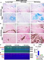 CDKN2C Antibody in Western Blot (WB)