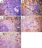 S100A9 Antibody in Immunohistochemistry (IHC)