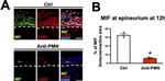 MIF Antibody in Immunohistochemistry (PFA fixed) (IHC (PFA))