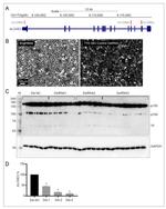 ALOXE3 Antibody in Western Blot (WB)