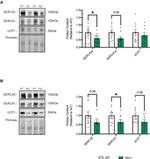 SERCA1 ATPase Antibody in Western Blot (WB)