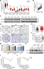 ZNF276 Antibody in Western Blot (WB)