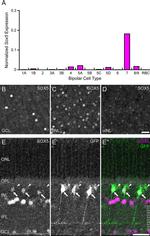 SOX5 Antibody in Immunohistochemistry (IHC)