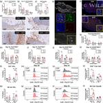 FOXP3 Antibody in Immunohistochemistry (IHC)