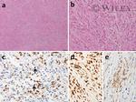 Calretinin Antibody in Immunohistochemistry (IHC)