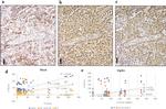 Calretinin Antibody in Immunohistochemistry (IHC)