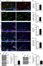 Ki-67 Antibody in Immunohistochemistry (IHC)