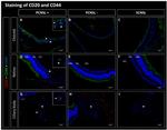 CD44 Antibody in Immunohistochemistry (IHC)