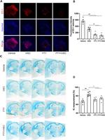 FOXP3 Antibody in Immunohistochemistry, Immunocytochemistry (IHC, ICC/IF)