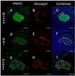 Glucagon Antibody in Immunohistochemistry (IHC)
