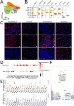 PLA2G2A Antibody in Immunohistochemistry (IHC)