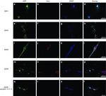 HuC/HuD Antibody in Immunohistochemistry (IHC)