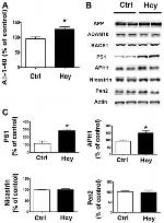 PEN2 Antibody in Western Blot (WB)