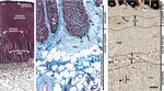 PGP9.5 Antibody in Immunohistochemistry (IHC)