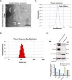 Annexin A1 Antibody in Western Blot (WB)