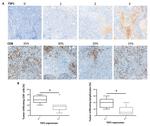 Thrombospondin 1 Antibody in Immunohistochemistry (IHC)