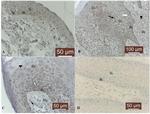 MMP9 Antibody in Immunohistochemistry (Paraffin) (IHC (P))