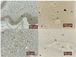 MMP14 Antibody in Immunohistochemistry (Paraffin) (IHC (P))