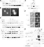 PGK1 Antibody in Western Blot (WB)