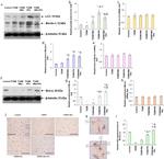 Beclin 1 Antibody in Western Blot (WB)
