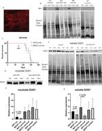 RFP Antibody in Immunohistochemistry (IHC)