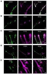 MBP Antibody in Immunohistochemistry (IHC)