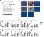 NPC1L1 Antibody in Western Blot (WB)