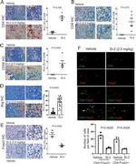 FOXP3 Antibody in Immunohistochemistry (IHC)