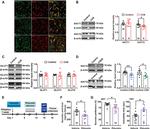 GLUT1 Antibody in Western Blot (WB)