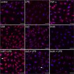 CXCR7 Antibody in Immunocytochemistry (ICC/IF)