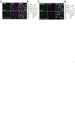 SPRR1A Antibody in Immunohistochemistry (IHC)