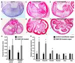 HOXA4 Antibody in Immunohistochemistry (IHC)
