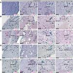 PCSK9 Antibody in Immunohistochemistry (IHC)