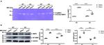 MMP14 Antibody in Western Blot (WB)