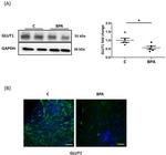 GLUT1 Antibody in Western Blot, Immunohistochemistry (WB, IHC)