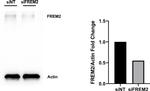 FREM2 Antibody in Western Blot (WB)