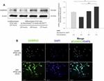 GABRG2 Antibody in Western Blot, Immunocytochemistry (WB, ICC/IF)