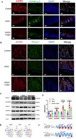 SUV39H1 Antibody in Western Blot (WB)