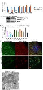 GPR123 Antibody in Immunocytochemistry (ICC/IF)