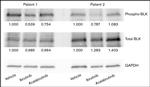 Phospho-BLK (Tyr389) Antibody in Western Blot (WB)