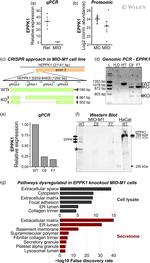 EPPK1 Antibody in Western Blot (WB)