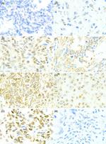 uPAR Antibody in Immunohistochemistry (Paraffin) (IHC (P))