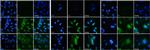 uPAR Polyclonal Antibody