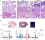 CD68 Antibody in Immunohistochemistry (IHC)