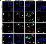 Rabbit IgG (H+L) Cross-Adsorbed Secondary Antibody in Immunocytochemistry (ICC/IF)