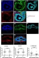 Cytokeratin 19 Antibody in Immunohistochemistry (Paraffin), Immunocytochemistry (IHC (P), ICC/IF)