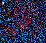 Rabbit IgG (H+L) Highly Cross-Adsorbed Secondary Antibody in Immunocytochemistry (ICC/IF)